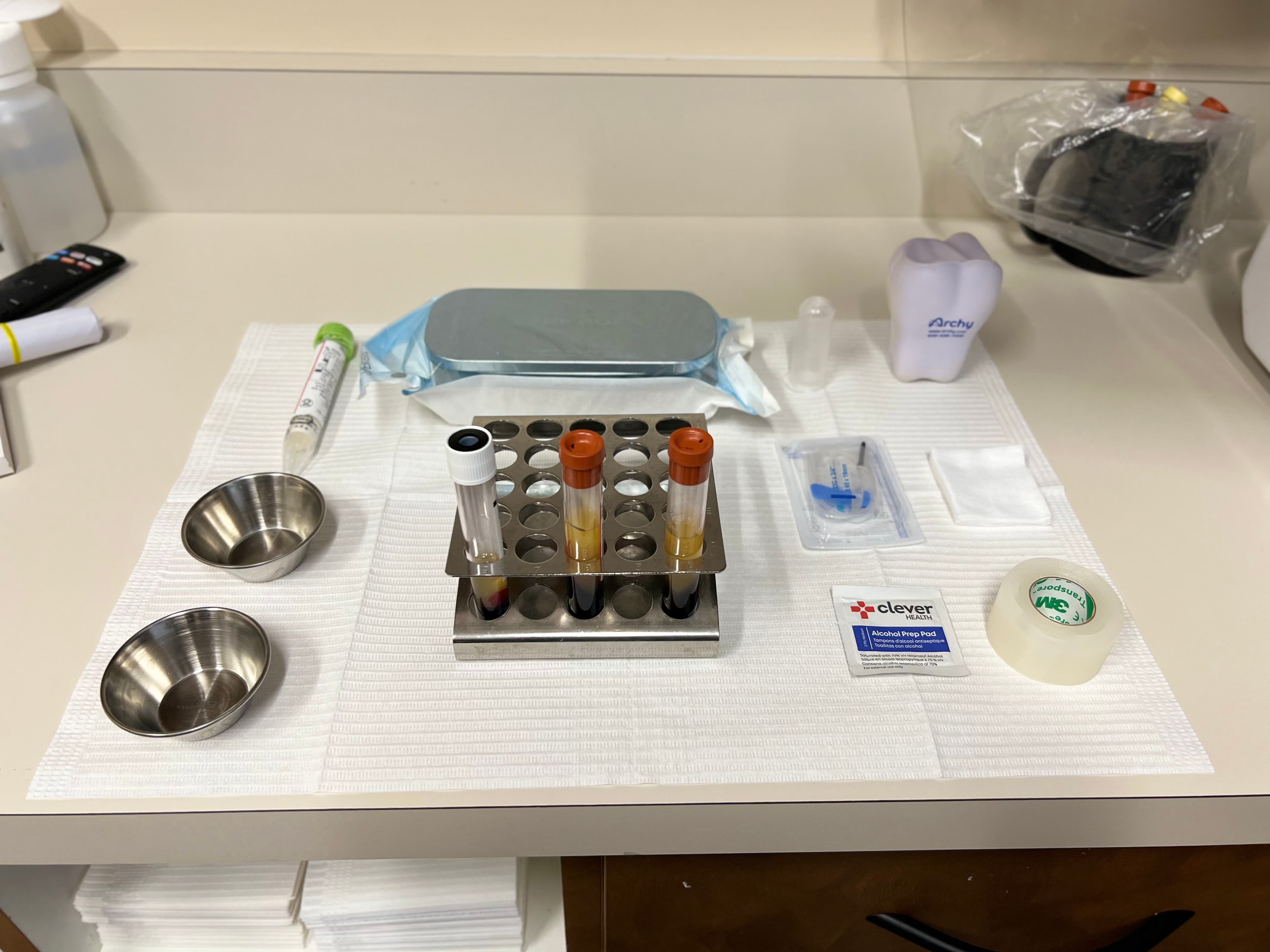 Platelet Rich Fibrin Therapy