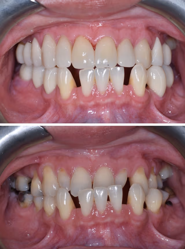 Cosmetic Dentistry Before & After